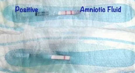 how to tell if your leaking amniotic fluid|Leaking Amniotic Fluid: Signs in 1st to 3rd Trimester